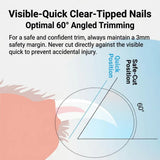 Load image into Gallery viewer, Diagram showing the optimal 60-degree angled trimming position for rabbit nails, using the LED light to maintain a 3mm safety margin from the visible quick.